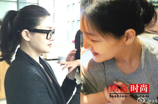 大S幸福生娃后 她曾经的美容金句简直是天雷滚滚