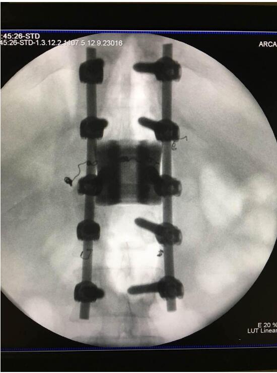 将3D打印引入医疗，华钛三维将加快融资脚步-智慧财经网