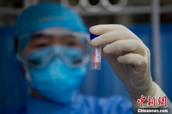 资料图：3月13日，山西省太原市杏花岭区，坝陵桥社区卫生服务中心的医疗人员查看返岗复工人员咽拭子采样标本。a target='_blank' href='http://www.chinanews.com/'中新社/a记者 韦亮 摄