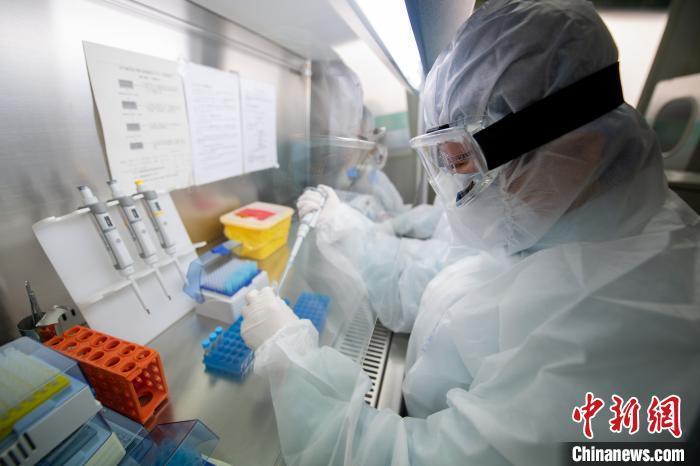 资料图:医疗人员对复工人员样本进行核酸检测。韦亮 摄 资料图:医疗人员对复工人员样本进行核酸检测。韦亮 摄