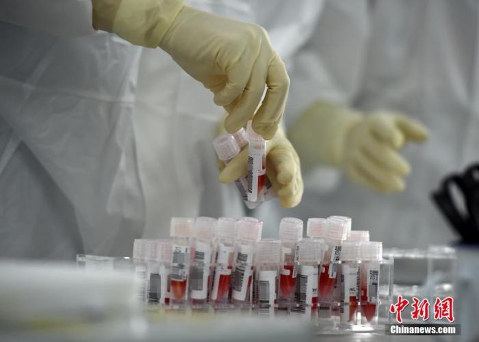 实验室工作人员整理刚刚送来的经预处理后的样本。a target='_blank' href='http://www.chinanews.com/'中新社/a记者 侯宇 摄 实验室工作人员整理刚刚送来的经预处理后的样本。a target='_blank' href='http://www.chinanews.com/'中新社/a记者 侯宇 摄