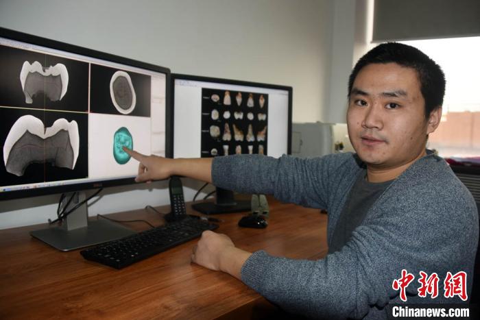 邢松研究员介绍对梅铺古人类牙齿化石进行显微断层扫描（micro-CT）相关情况。孙自法摄